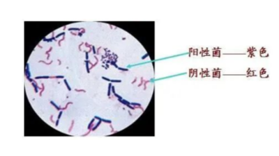 豬病毒性疾病與細菌性疾病常見病的區(qū)分-上海邦森